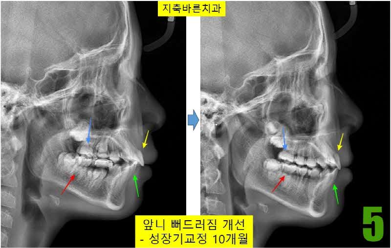 5. 10개월 셉_s.jpg