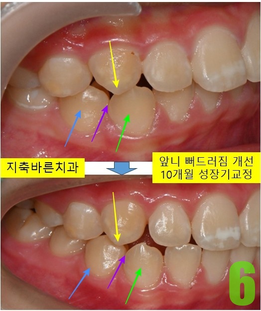 6. 10개월 측면.jpg
