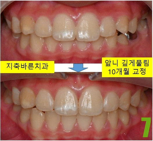 7. 10개월 정면.jpg