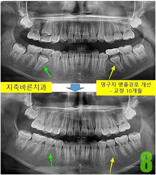 8. 10개월 파노.jpg