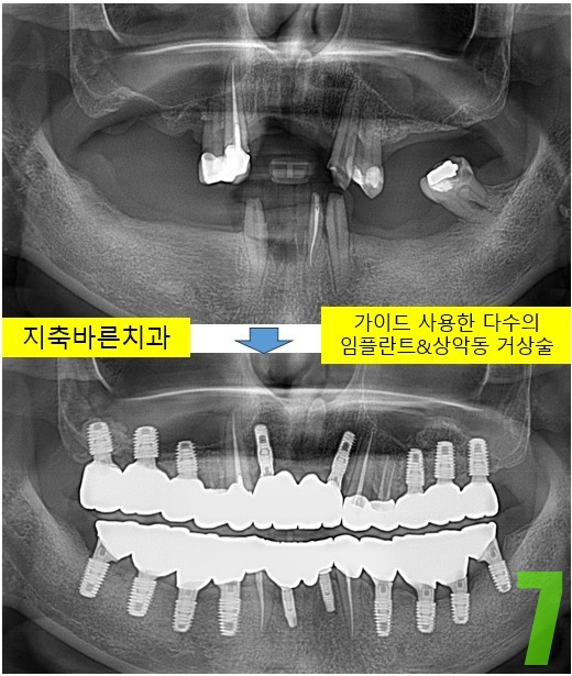 7. 치료전후.jpg