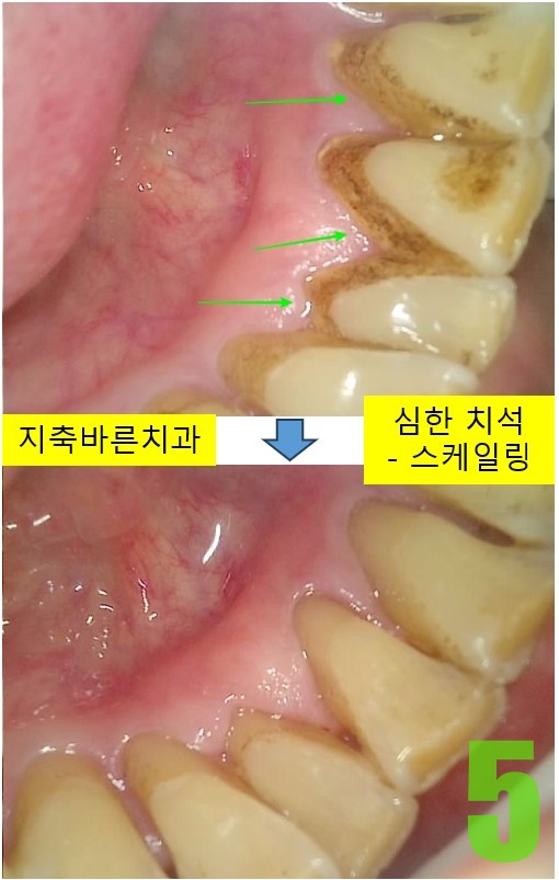 5. 스케일링.jpg