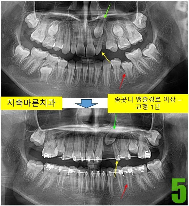 5. 교정 1년.jpg
